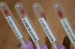 Hantavirus təlaşı böyüyür